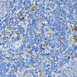 Immunohistochemistry - Anti-TNF Receptor I Antibody (A13494) - Antibodies.com