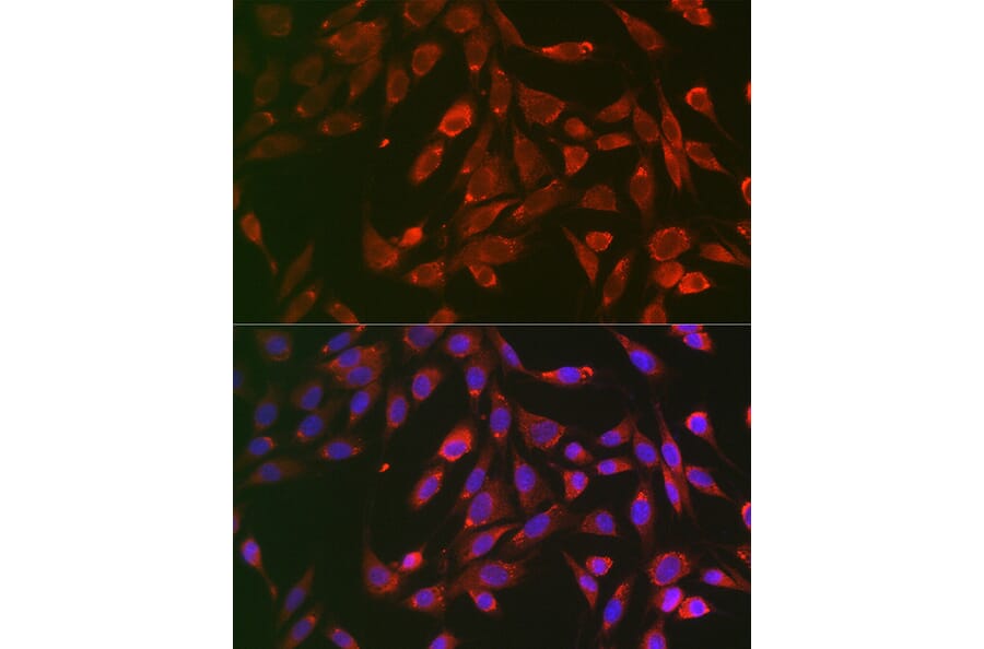 Immunofluorescence - Anti-TNF Receptor I Antibody (A13494) - Antibodies.com