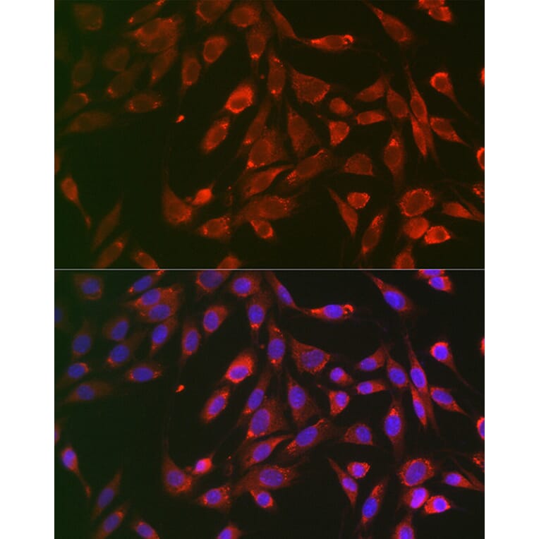 Immunofluorescence - Anti-TNF Receptor I Antibody (A13494) - Antibodies.com