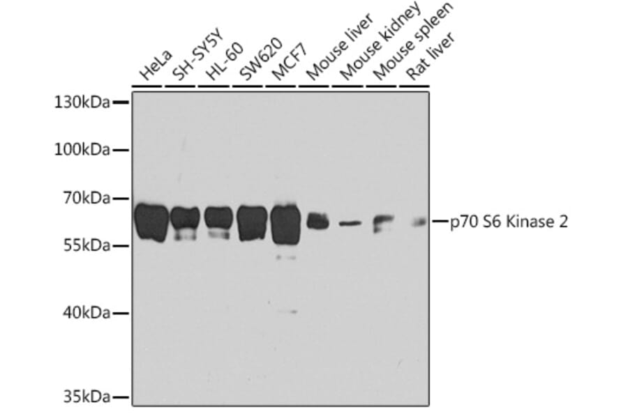 Western Blot - Anti-P70 S6 Kinase beta/SRK Antibody (A13495) - Antibodies.com