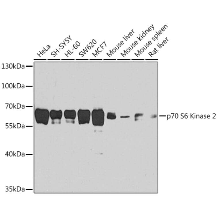 Western Blot - Anti-P70 S6 Kinase beta/SRK Antibody (A13495) - Antibodies.com
