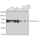 Western Blot - Anti-P70 S6 Kinase beta/SRK Antibody (A13495) - Antibodies.com