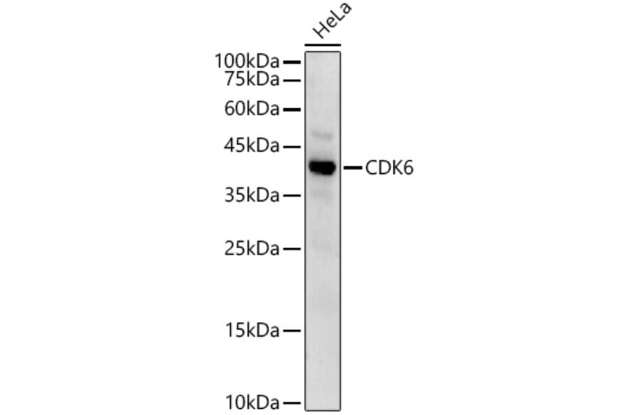 Western Blot - Anti-Cdk6 Antibody (A13498) - Antibodies.com