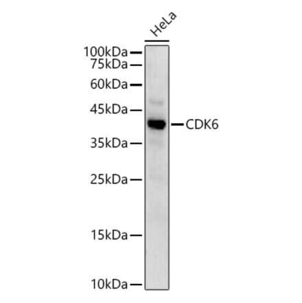 Western Blot - Anti-Cdk6 Antibody (A13498) - Antibodies.com