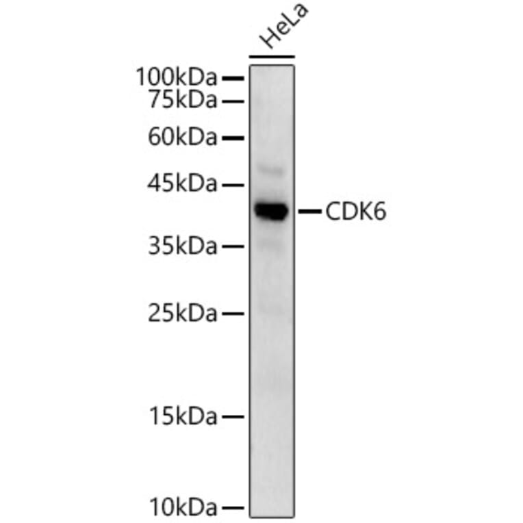 Western Blot - Anti-Cdk6 Antibody (A13498) - Antibodies.com