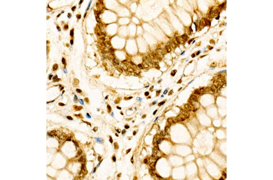 Immunohistochemistry - Anti-Cdk6 Antibody (A13498) - Antibodies.com