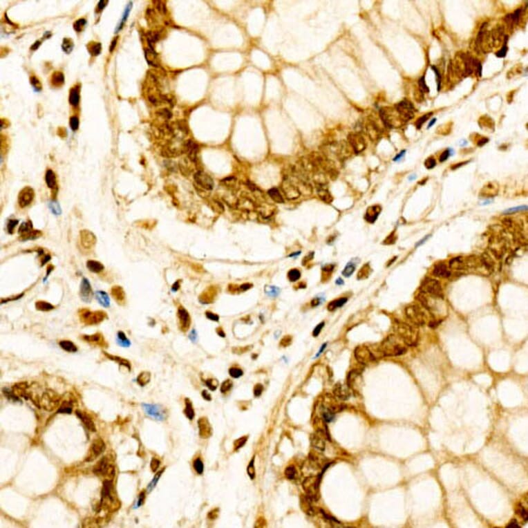 Immunohistochemistry - Anti-Cdk6 Antibody (A13498) - Antibodies.com
