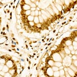 Immunohistochemistry - Anti-Cdk6 Antibody (A13498) - Antibodies.com