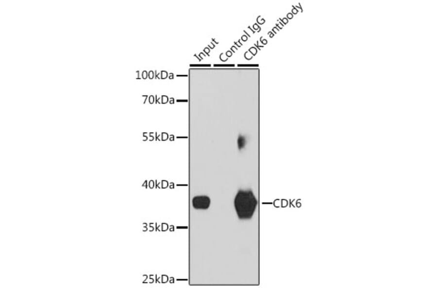 Western Blot - Anti-Cdk6 Antibody (A13498) - Antibodies.com