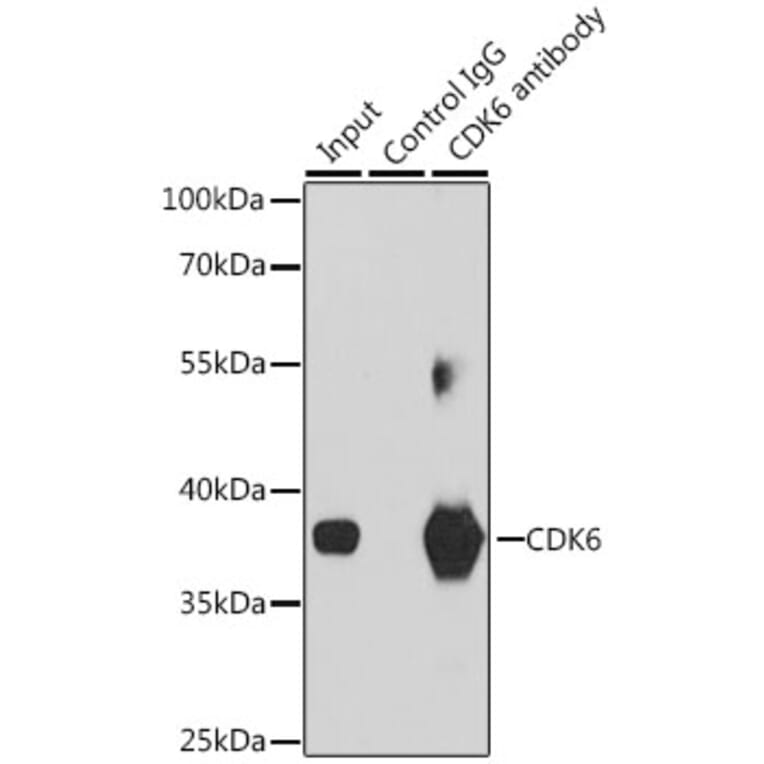 Western Blot - Anti-Cdk6 Antibody (A13498) - Antibodies.com