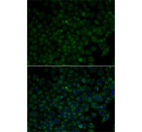 Immunofluorescence - Anti-ANG Antibody (A1546) - Antibodies.com