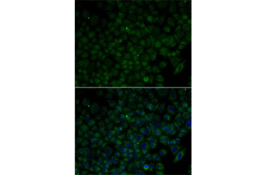 Immunofluorescence - Anti-ANG Antibody (A1546) - Antibodies.com
