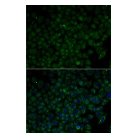 Immunofluorescence - Anti-ANG Antibody (A13499) - Antibodies.com