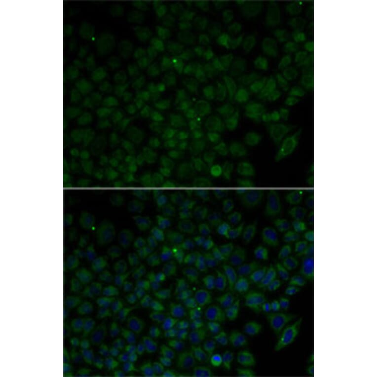 Immunofluorescence - Anti-ANG Antibody (A1546) - Antibodies.com
