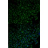 Immunofluorescence - Anti-ANG Antibody (A1546) - Antibodies.com