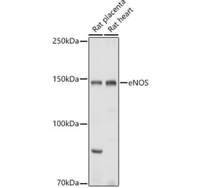 Western Blot - Anti-eNOS Antibody (A13501) - Antibodies.com