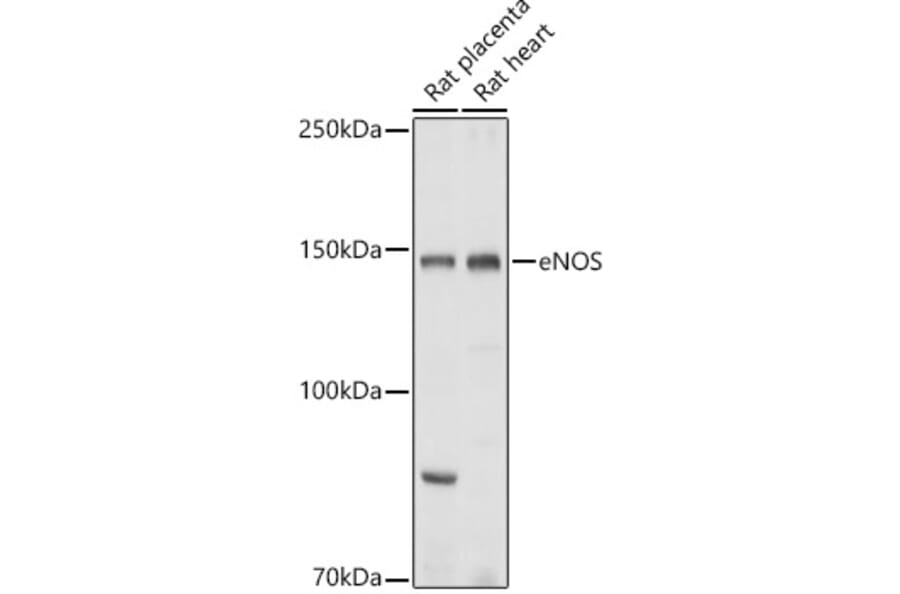 Western Blot - Anti-eNOS Antibody (A13501) - Antibodies.com