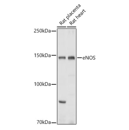 Western Blot - Anti-eNOS Antibody (A13501) - Antibodies.com
