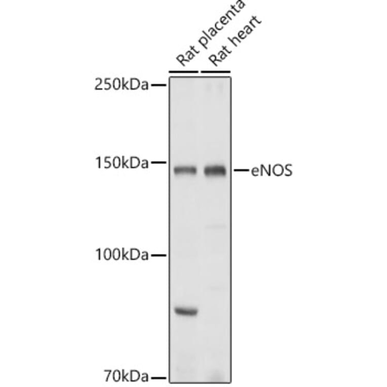 Western Blot - Anti-eNOS Antibody (A13501) - Antibodies.com