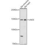 Western Blot - Anti-eNOS Antibody (A13501) - Antibodies.com