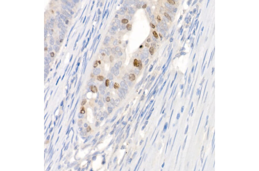 Immunohistochemistry - Anti-Survivin Antibody (A13502) - Antibodies.com
