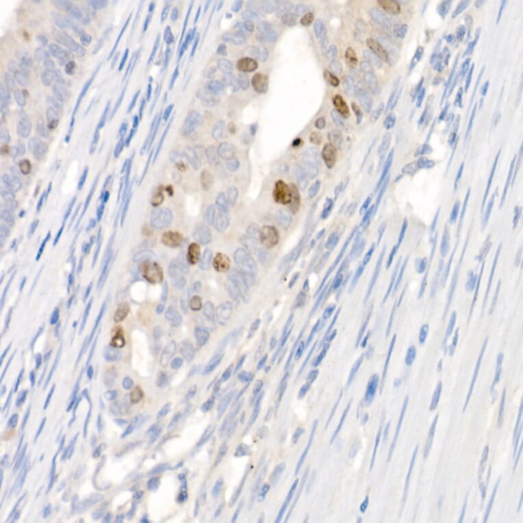 Immunohistochemistry - Anti-Survivin Antibody (A13502) - Antibodies.com