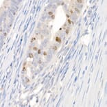 Immunohistochemistry - Anti-Survivin Antibody (A13502) - Antibodies.com