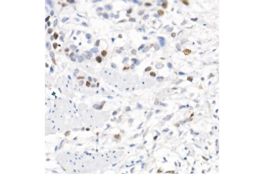 Immunohistochemistry - Anti-Survivin Antibody (A13502) - Antibodies.com