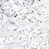 Immunohistochemistry - Anti-Survivin Antibody (A13502) - Antibodies.com