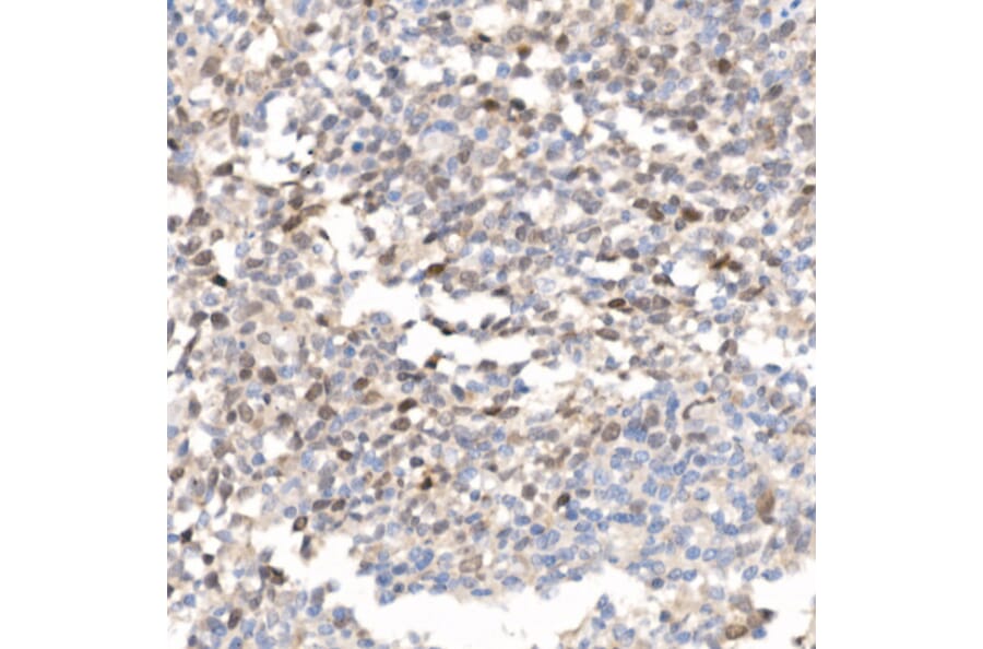 Immunohistochemistry - Anti-Survivin Antibody (A13502) - Antibodies.com