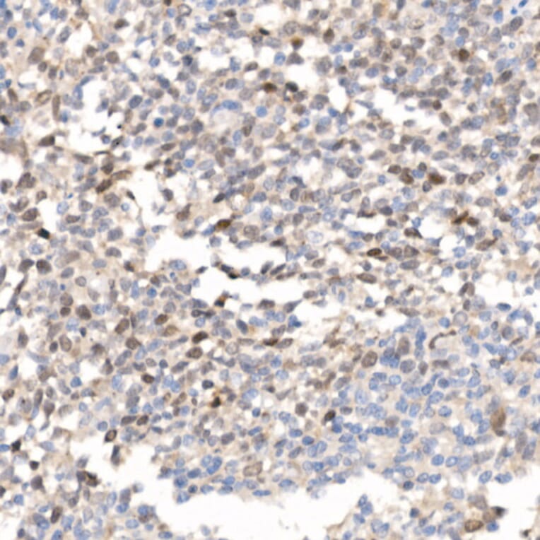 Immunohistochemistry - Anti-Survivin Antibody (A13502) - Antibodies.com