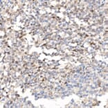 Immunohistochemistry - Anti-Survivin Antibody (A13502) - Antibodies.com