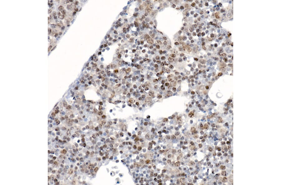 Immunohistochemistry - Anti-Survivin Antibody (A13502) - Antibodies.com