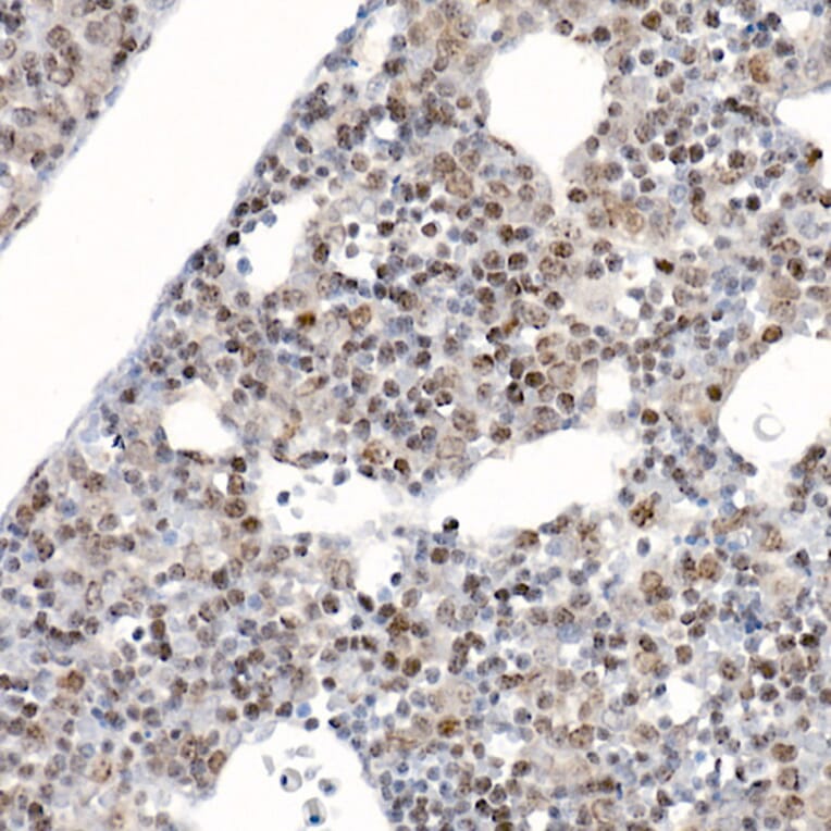Immunohistochemistry - Anti-Survivin Antibody (A13502) - Antibodies.com