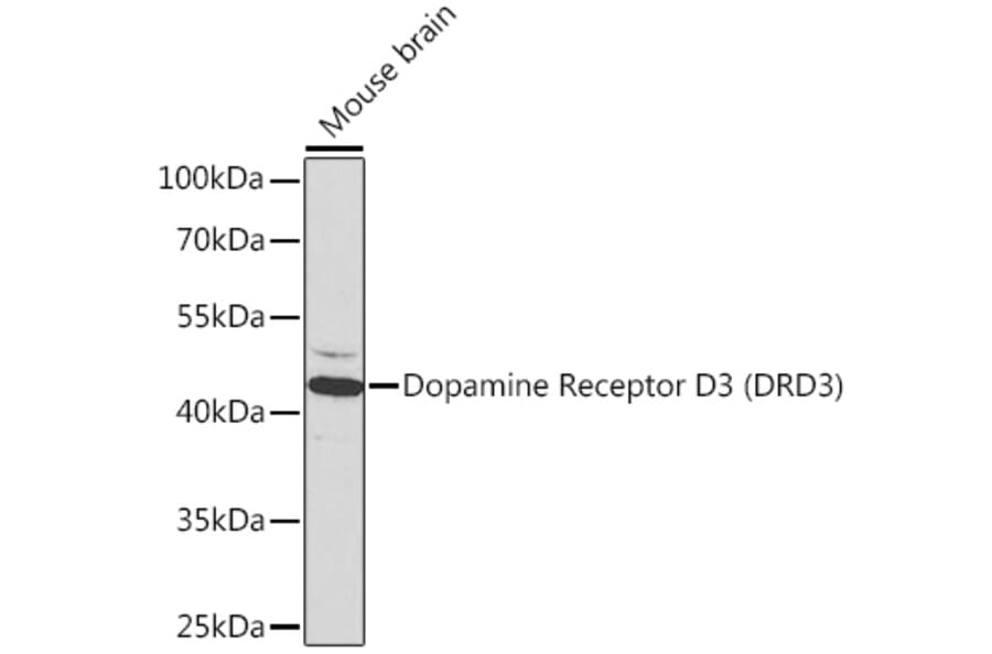 Western Blot - Anti-Dopamine Receptor D3/DRD3 Antibody (A13503) - Antibodies.com