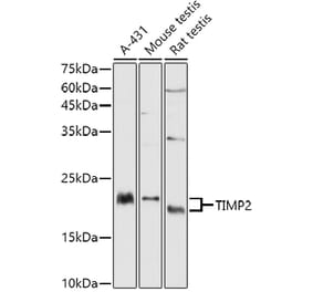 Western Blot - Anti-TIMP2 Antibody (A13504) - Antibodies.com
