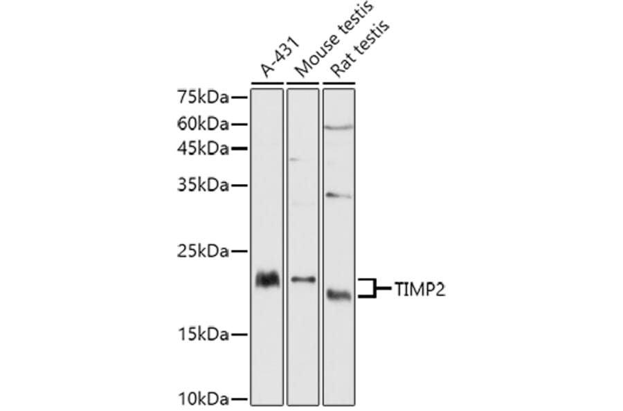 Western Blot - Anti-TIMP2 Antibody (A13504) - Antibodies.com