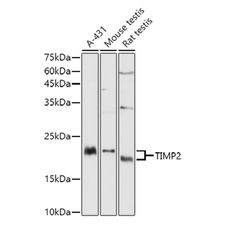 Western Blot - Anti-TIMP2 Antibody (A13504) - Antibodies.com