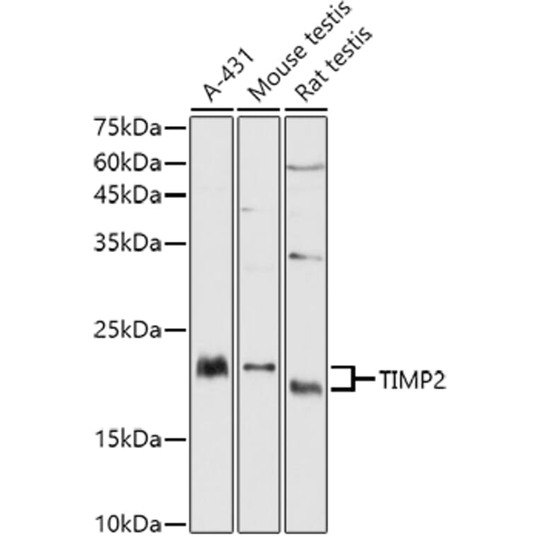 Western Blot - Anti-TIMP2 Antibody (A13504) - Antibodies.com