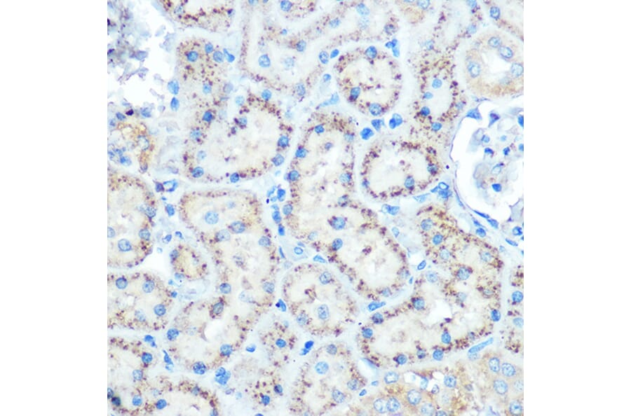 Immunohistochemistry - Anti-TIMP2 Antibody (A13504) - Antibodies.com