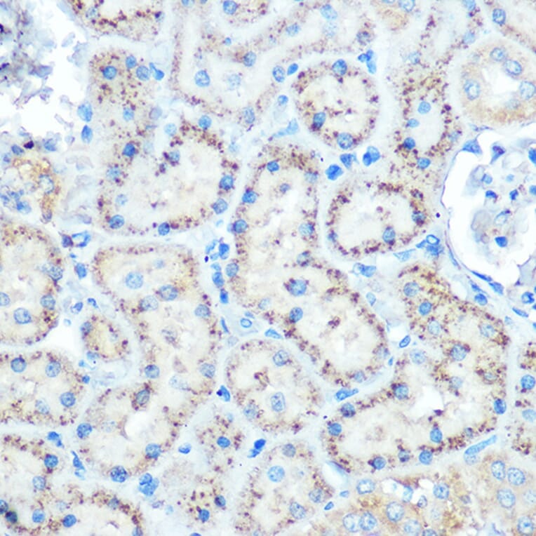 Immunohistochemistry - Anti-TIMP2 Antibody (A13504) - Antibodies.com