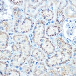 Immunohistochemistry - Anti-TIMP2 Antibody (A13504) - Antibodies.com