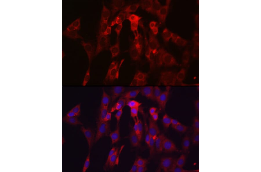 Immunofluorescence - Anti-TIMP2 Antibody (A13504) - Antibodies.com