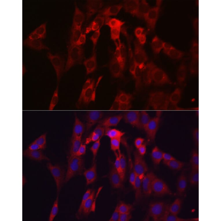 Immunofluorescence - Anti-TIMP2 Antibody (A13504) - Antibodies.com