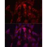 Immunofluorescence - Anti-TIMP2 Antibody (A13504) - Antibodies.com