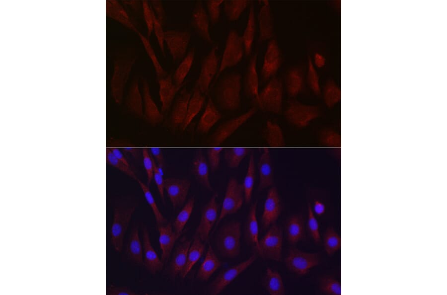 Immunofluorescence - Anti-TIMP2 Antibody (A13504) - Antibodies.com