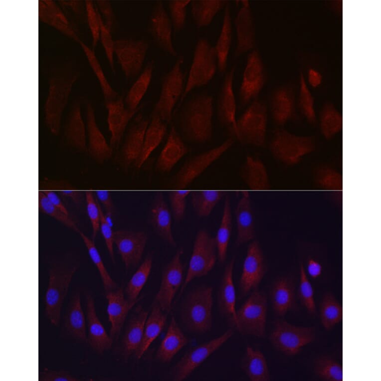 Immunofluorescence - Anti-TIMP2 Antibody (A13504) - Antibodies.com
