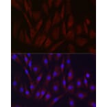 Immunofluorescence - Anti-TIMP2 Antibody (A13504) - Antibodies.com
