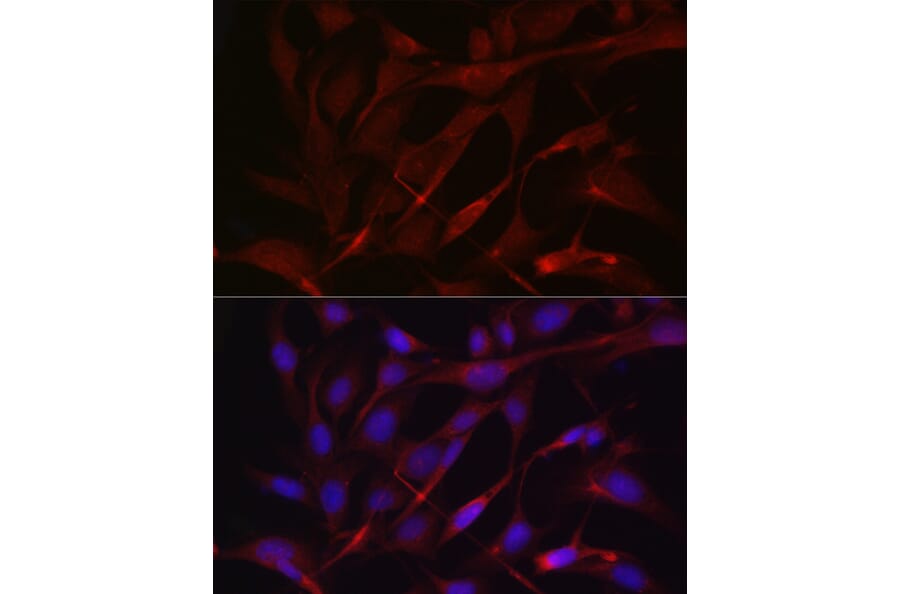 Immunofluorescence - Anti-TIMP2 Antibody (A13504) - Antibodies.com