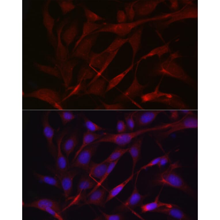 Immunofluorescence - Anti-TIMP2 Antibody (A13504) - Antibodies.com
